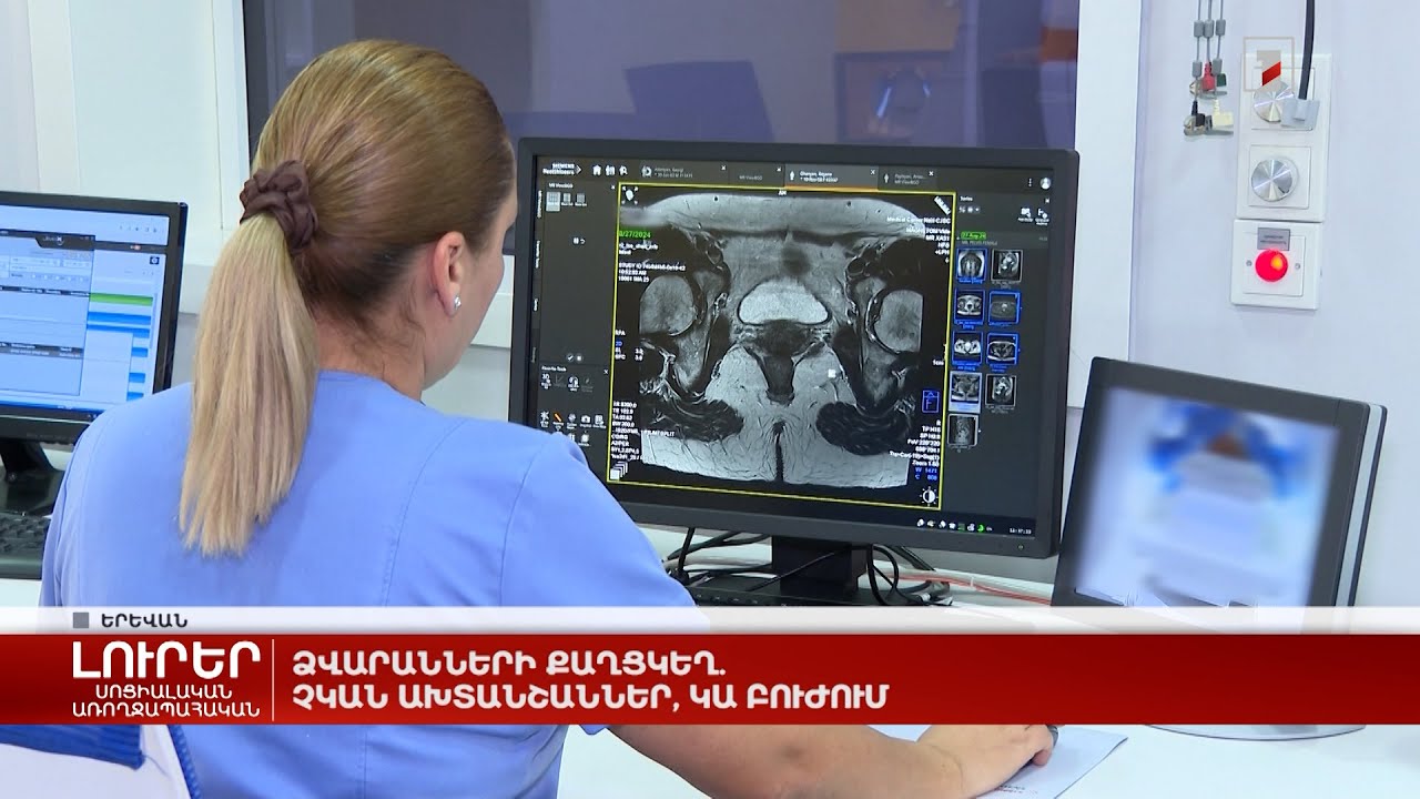 Ձվարանների քաղցկեղ. չկան ախտանշաններ, կա բուժում