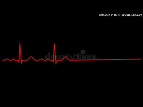 ShawtyMojo x Pronto Spazzout x SBG Kemo - Recuperate Remix