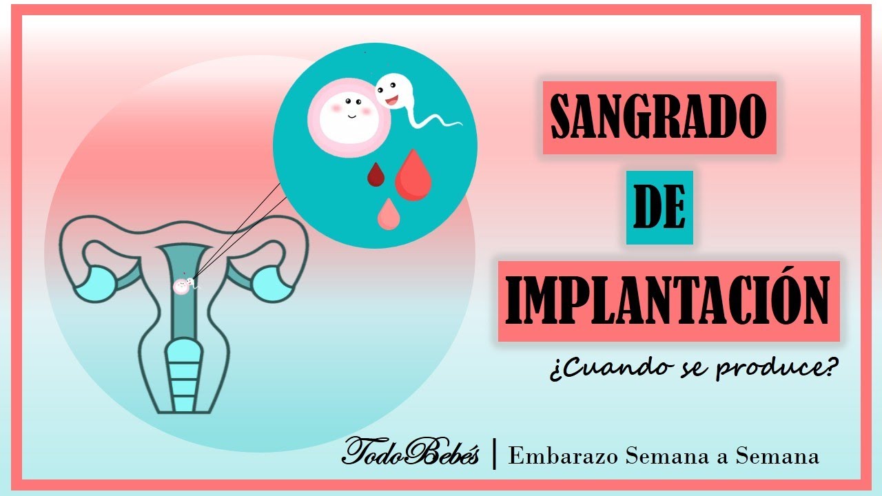 Watch ??¿Como saber si es Sangrado?? de Implantación o Menstruación ??DIFERENCIAS, SÍNTOMAS Y MAS!! Now ??¿Como saber si es Sangrado?? de Implantación o Menstruación ??DIFERENCIAS, SÍNTOMAS Y MAS!!