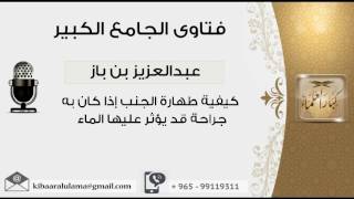 كيفية طهارة الجنب إذا كان به جراحة قد يؤثر عليها الماء - بن باز - مشروع كبار العلماء image