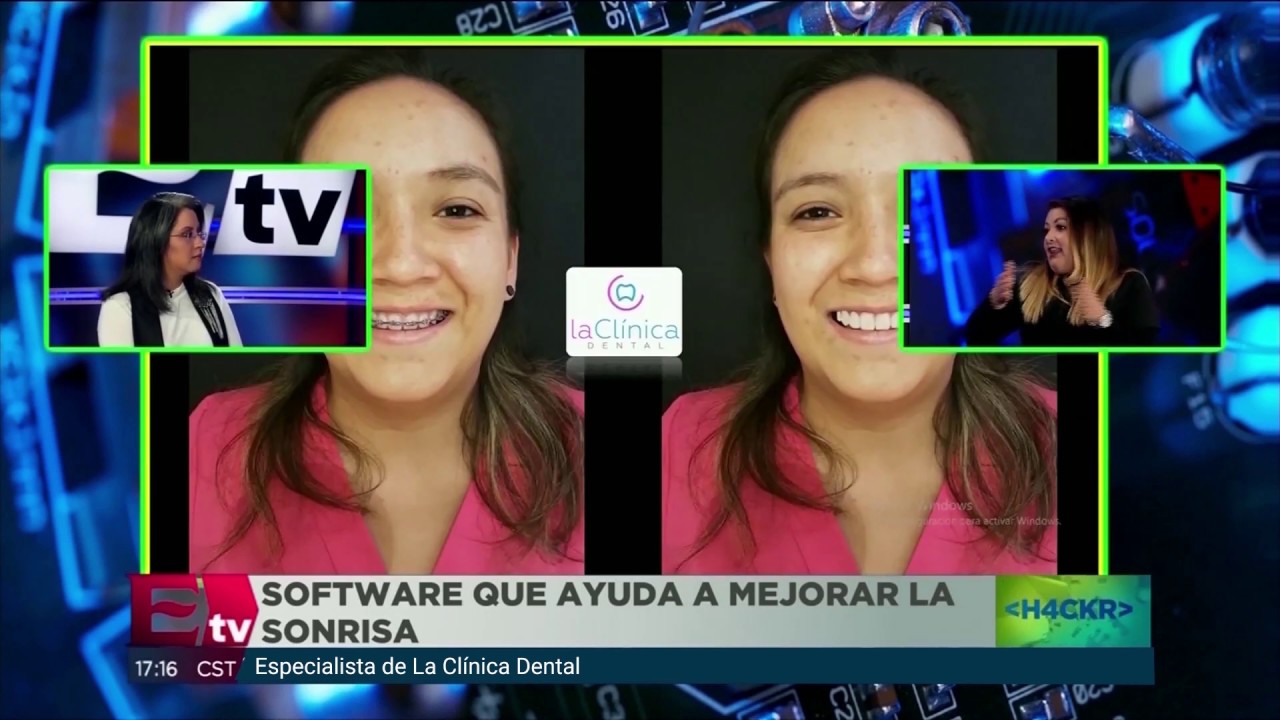 Mujer sonriendo con brackets en un programa de televisión sobre La Clínica Dental, destacando el software que mejora la sonrisa.