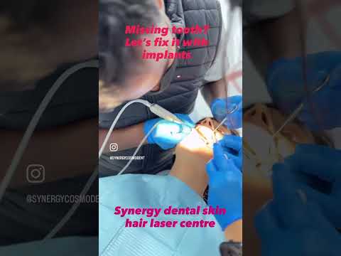 Dental Implants Replace Tooth &amp; Root | Synergy Dental &amp; Cosmetology Clinic