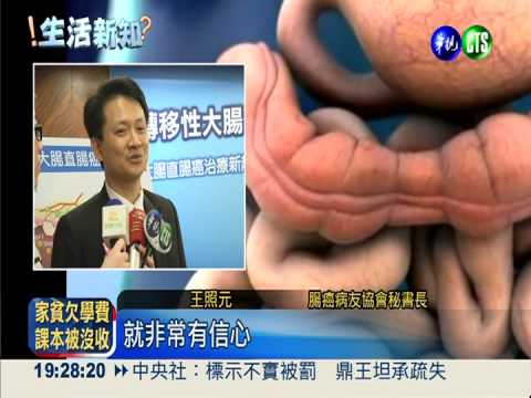 大腸癌患者福音! 口服標靶藥上市