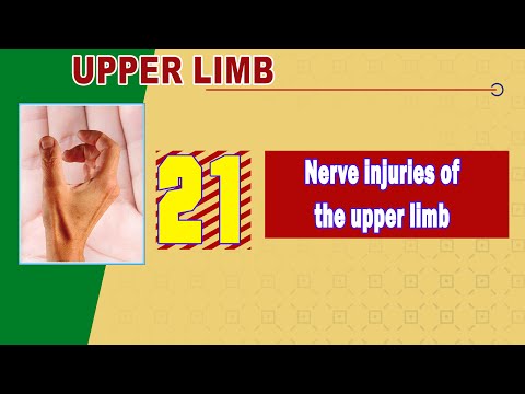 𝟐𝟏. 𝐍𝐞𝐫𝐯𝐞 𝐢𝐧𝐣𝐮𝐫𝐢𝐞𝐬 𝐨𝐟 𝐭𝐡𝐞 𝐮𝐩𝐩𝐞𝐫 𝐥𝐢𝐦𝐛 (𝐂𝐚𝐮𝐬𝐞𝐬 & 𝐜𝐥𝐢𝐧𝐢𝐜𝐚𝐥 𝐩𝐢𝐜𝐭𝐮𝐫𝐞) ✂️ (إصابات الأعصاب في الطرف العلوي)