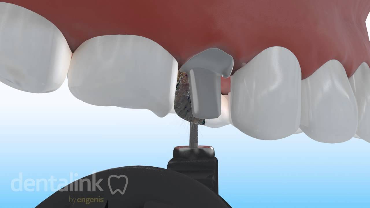 Hernán Andrés Febre Moscoso-25