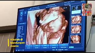 Download lagu Happy Birthday, bidadari kecilku mp3 Download lagu Happy Birthday, bidadari kecilku mp3