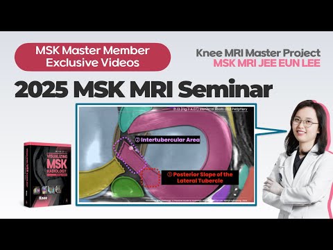 (Fig I.02.01) Lateral Meniscus Posterior Root: MRI Anatomy