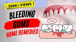 Bleedings Gums | Causes & Best Home Remedies