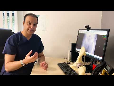 Mako Robotic Surgery Break Down