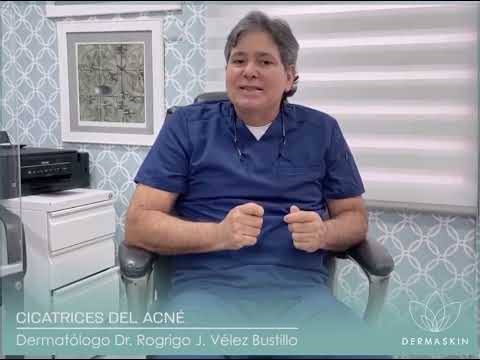 Tratamiento para cicatrices de acné en Cartagena por el Dermatólogo Rodrigo José Velez