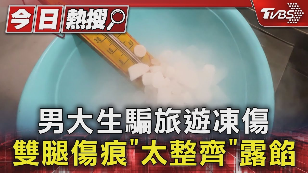 男大生騙旅遊凍傷 雙腿傷痕「太整齊」露餡