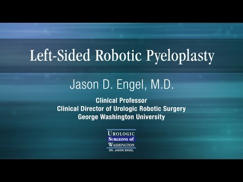 Left Sided Robotic Pyeloplasty