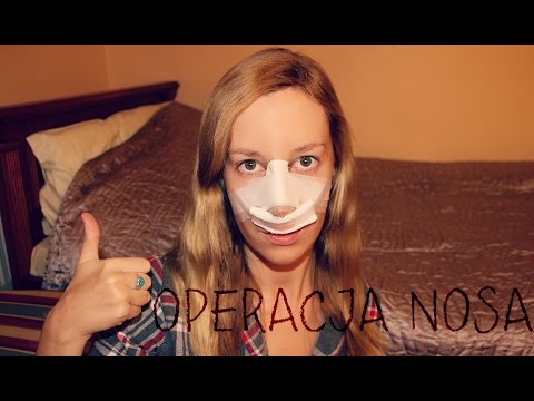Terapia ruchowa w instalacji wideo stopa płasko koślawego Zdjęcie blokady anty koślawego
