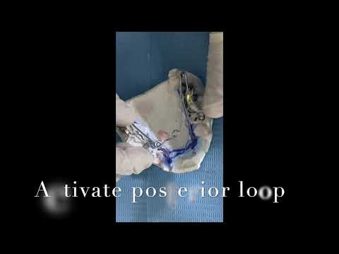 quad helix activation