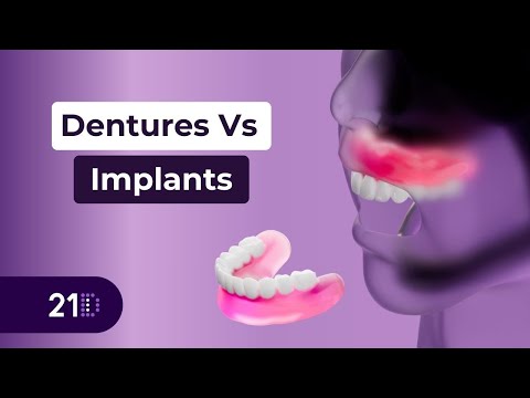 The Hidden Impact of Dentures on Bone Loss