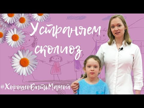 Упражнения при нарушении осанки кифоз Кифоз ребенок начинает сидеть