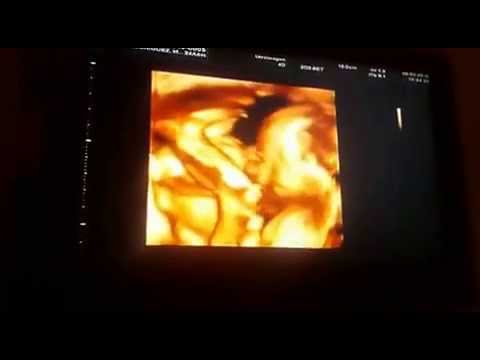 Dante Thomas ♡ Cute