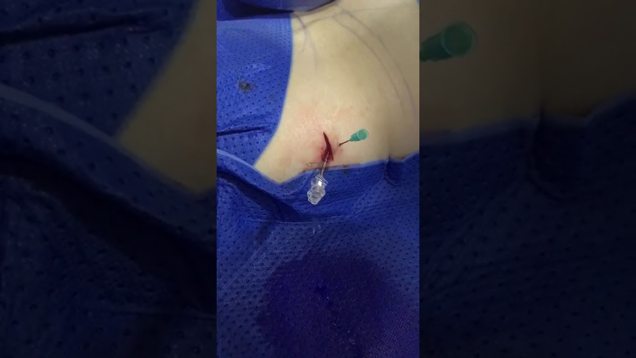 Joan Cristóbal Bassa Moyano-5