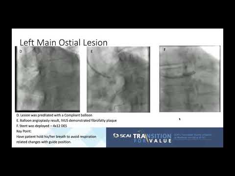 Module 9, Left Main and Bifurcation Lesion PCI with TRA Access