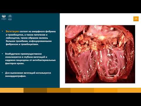 Terapiya fənni üzrə istinad materialları