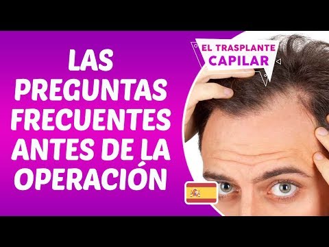¿Como es el proceso de trasplante capilar? - Dr. Hamid AYDIN