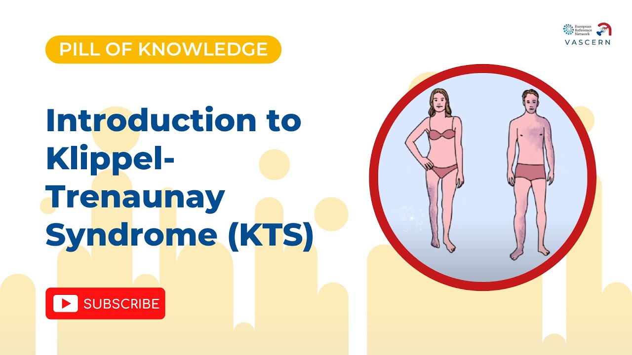 Introduction to Klippel-Trenaunay Syndrome (KTS)