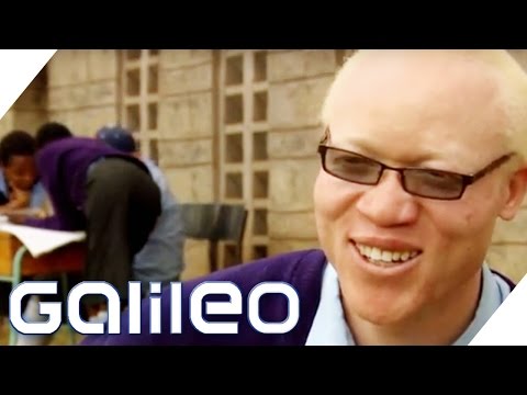 Albinos in Afrika | Galileo | ProSieben