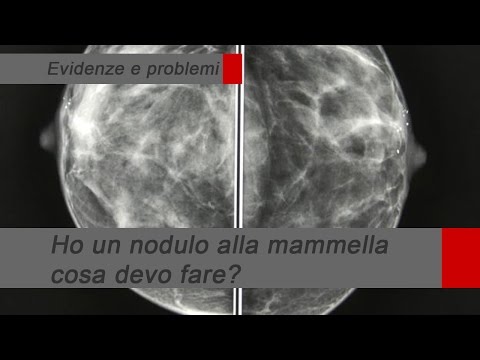 Tè per giunti di pulizia Posso usare il gel Fastum osteocondrosi
