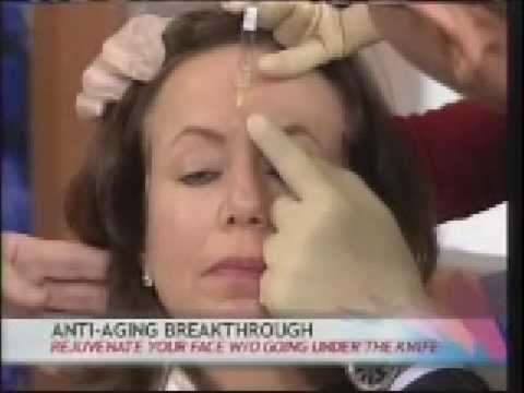 youtube Facial Rejuvenation Procedures on Fox