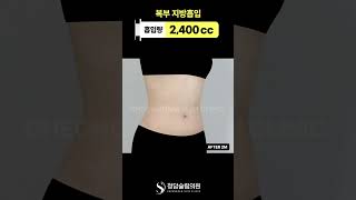 허리 통자 → 이렇게 잘록해질 수 있음?😳