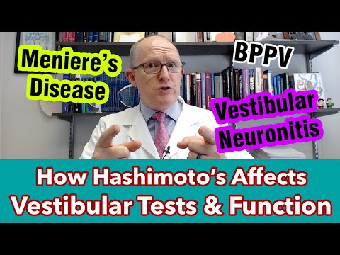 Chronic Vertigo? How Hashimoto’s Affects Vestibular Tests (caloric, OKN, VOR)