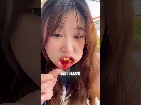 My Mouth Hurts So Much! 😖🦷💥