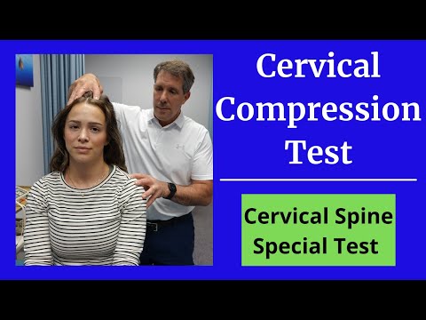 Positive Hoffman s Sign Hyperreflexia and Spurling s Test