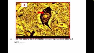 Revision cytology data show 2016