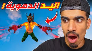 صار عندي اليد الدموية !!