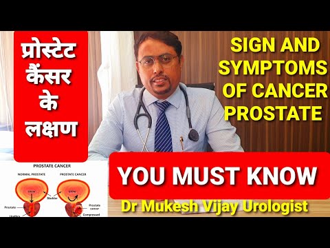prostate cancer symptoms \prostate cancer signs\prostate cancer treatment\prostate cancer ke lakshan