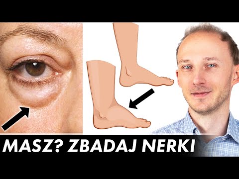 11 oznak na ciele, że czas zbadać nerki - niewydolność nerek: objawy | Dr Bartek Kulczyński