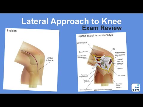 Lateral Approach to the Knee Exam Review - Ron Delanois, MD