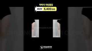 다이어트 안 했는데 성공함