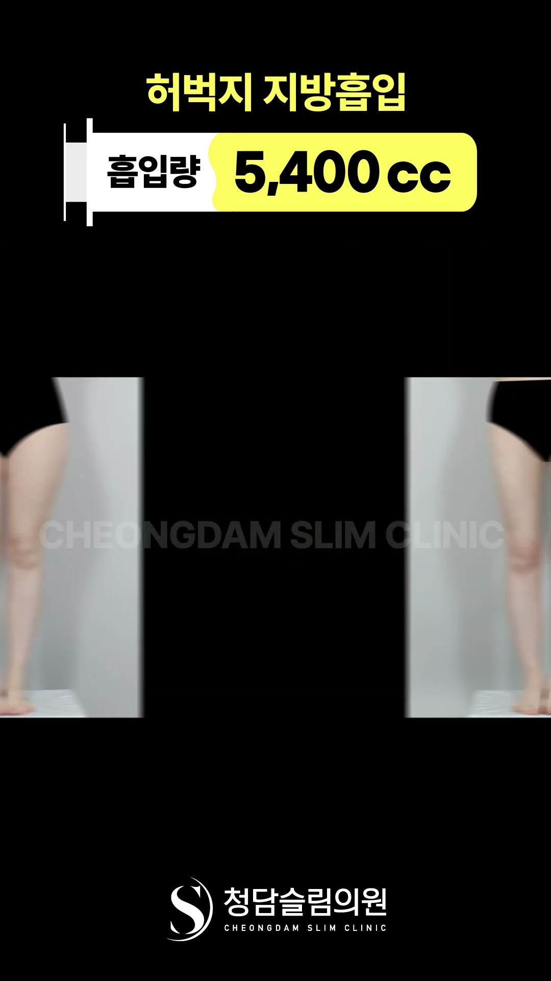 다이어트 안 했는데 성공함