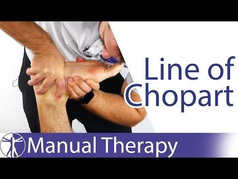 Line of Chopart | Midfoot Assessment & Mobilization