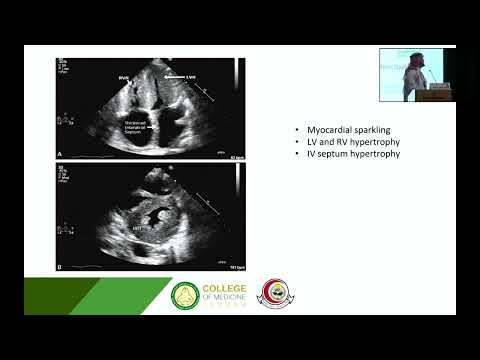 Advances in AL Amyloidosis | Dr. Majed Al Ahmadi (17 Feb 2024)