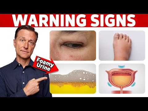 The Top SUPERFOODS for the Kidneys—Explained by Dr Berg