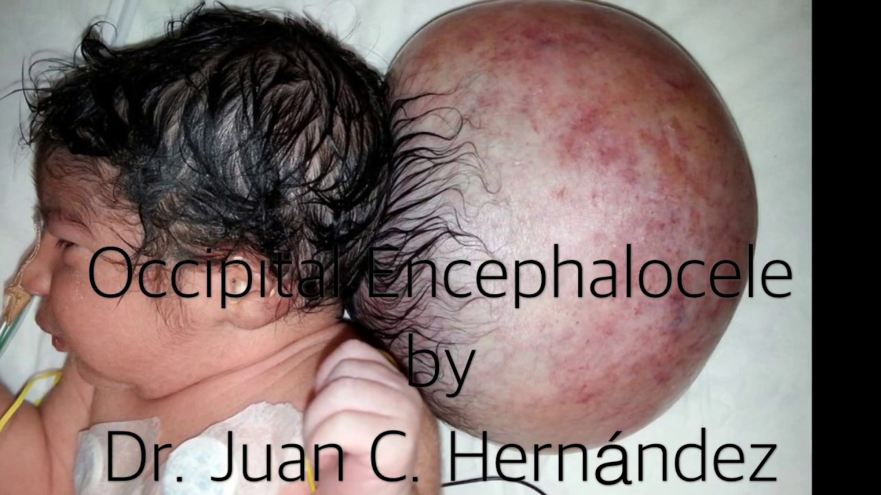 Juan Camilo Hernandez Acevedo-67