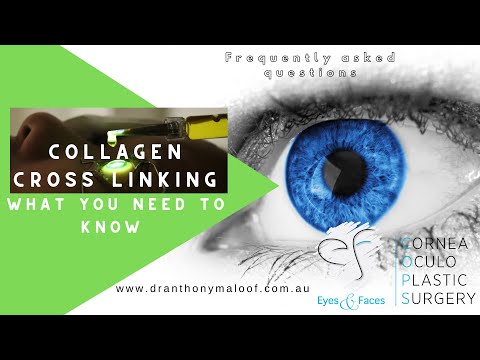 FAQ Collagen Cross Linking - What you need to know - Keratoconus - Dr Anthony Maloof, Sydney AU