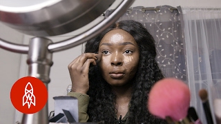 How a Burn Victim Became a Beauty Inspiration