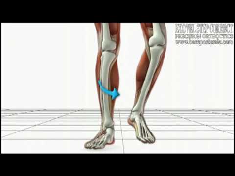 Unguento con veleno di serpente per il prezzo congiunta Cervicali modi popolari di trattamento osteocondrosi