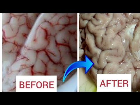 How to remove veins and clean brain easily Video