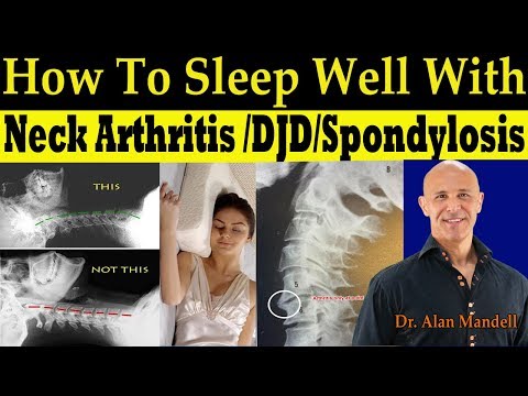 How To Sleep Well With Neck Arthritis/DJD/ Spondylosis - Dr. Alan Mandell, DC