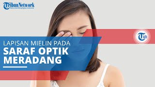Neuritis Optik, Kondisi Mata ketika Lapisan Mielin pada Saraf Optik Meradang